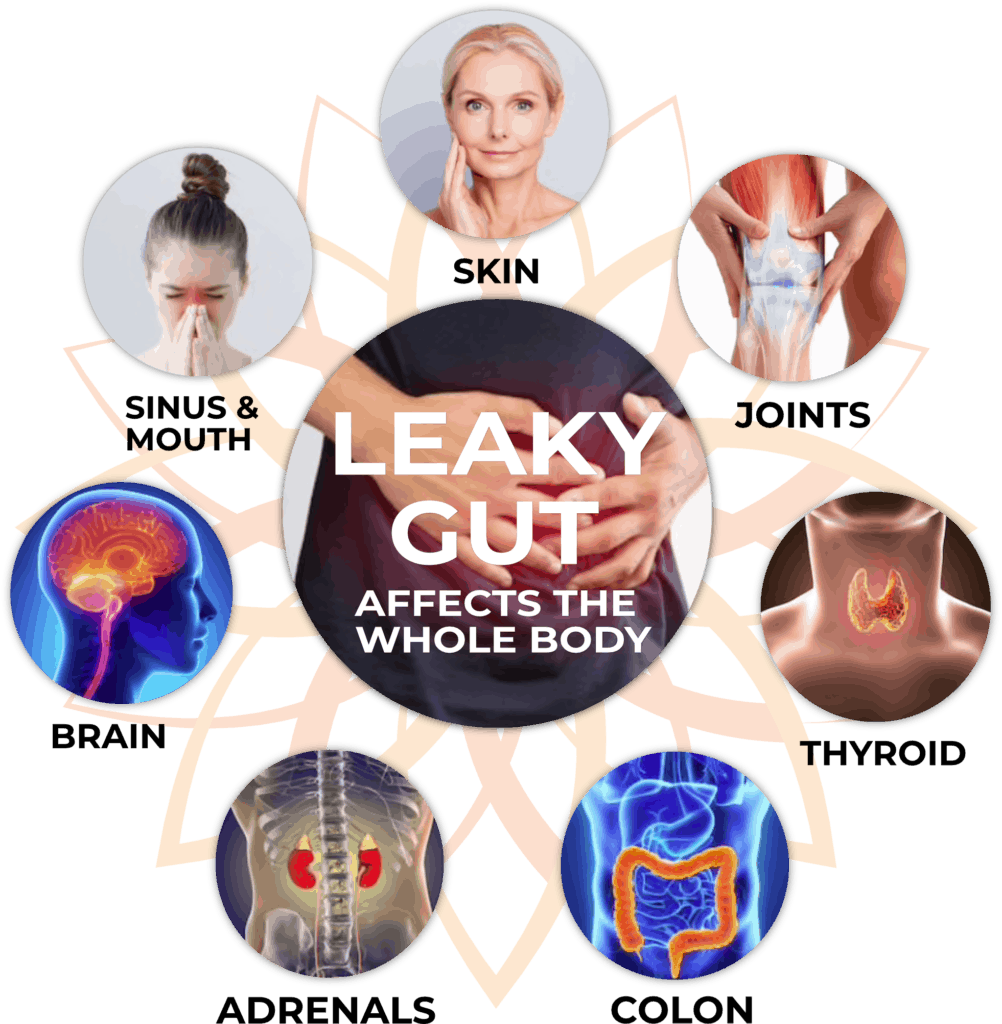 Leaky gut help